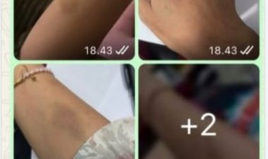 Aktivis KOMPPAK Akan Lakukan Aksi Unras,  Terkait Dugaan Okum Anggota DPRD Pandeglang Fraksi PKS Aniaya Mantan Pacar